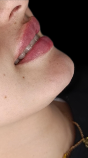 ✨عروض تجميل حصرية في مركز تريندي بالشعلان بأسعار تنافسية✨