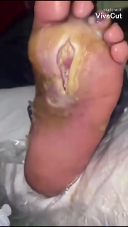 ممرض منزلي في دمشق